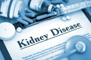 Senior Home Care Merced CA - Tips Seniors Can Use For Better Kidney Health